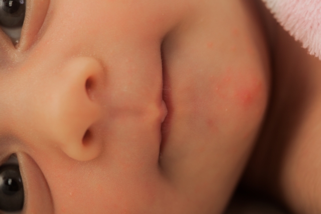 赤ちゃんの鼻くそ どうしたらいい 妊婦さん応援ブログ 妊娠中 不妊治療 うつ病 甲状腺治療の方でもお申込みできる医療保険エブリワン